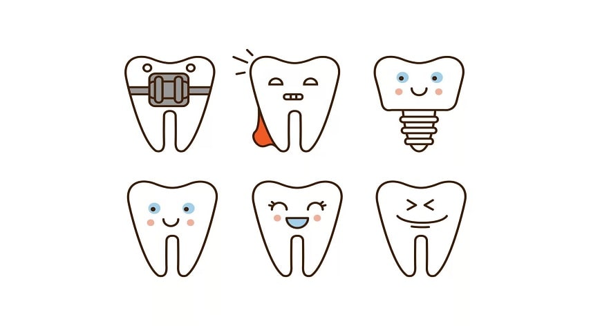 dental implant providers