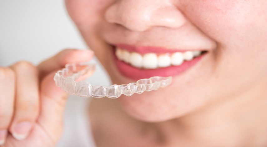 how does invisalign work