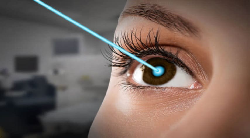 Laser Eye Surgery