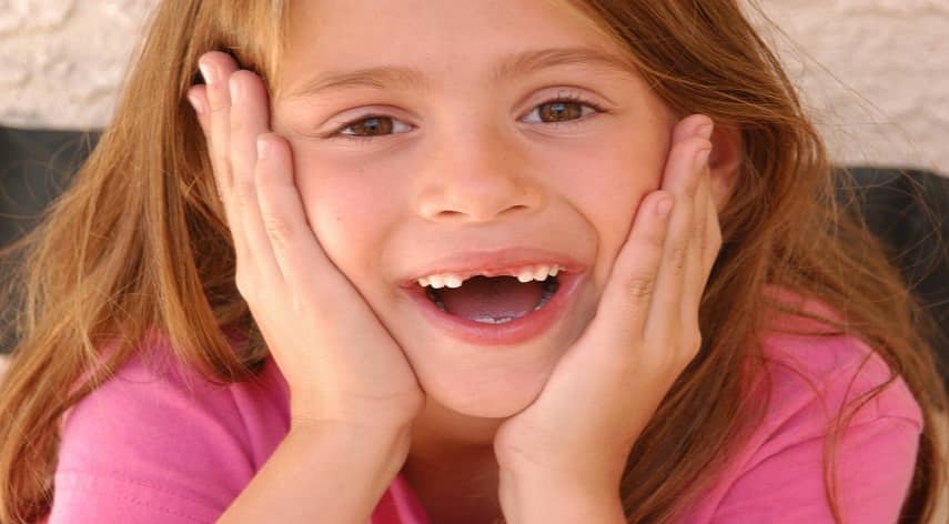 missing front teeth