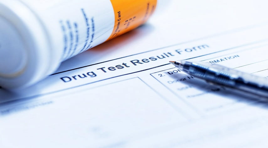 nail follicle drug test