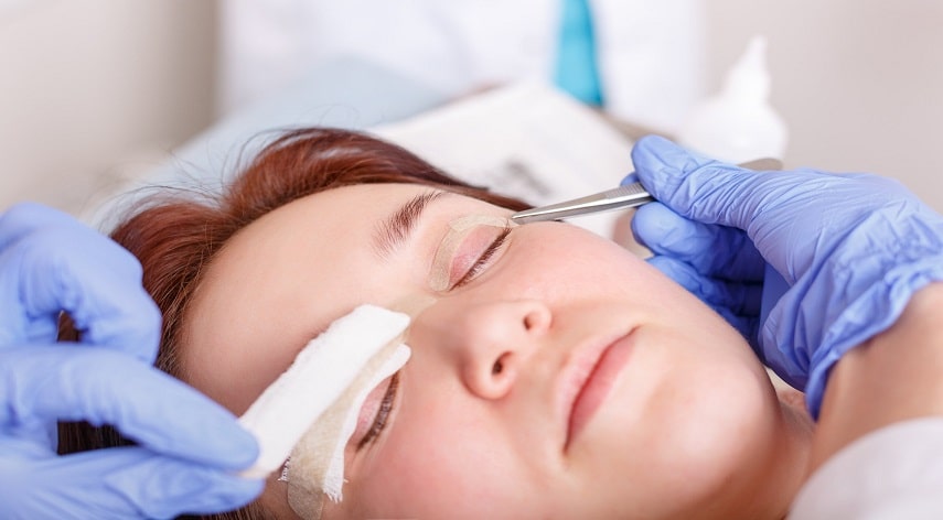 upper blepharoplasty scars